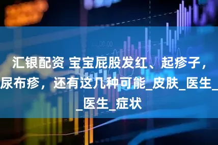 汇银配资 宝宝屁股发红、起疹子，除了尿布疹，还有这几种可能_皮肤_医生_症状